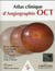 Atlas d angiographie. oct clinique