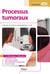 UE 2.9 processus tumoraux