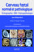 Cerveau foetal normal et pathologique : Échographie, IRM, Foetopathologie
