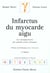 Infarctus du myocarde aigu 2ed