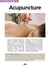 Acupuncture