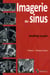 Imagerie des sinus