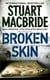 Broken skin