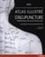 Atlas illustré d'acupuncture - représentation des points d'acupuncture