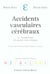 Accidents vasculaires cerebraux