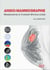 Angio-mammographie : Mammographie de contraste spectrale (CESM)