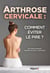 Arthrose cervicale : comment eviter le pire ?