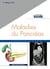 Maladies du pancréas - savoir utile !