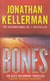 Bones