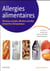 Allergies alimentaires - nouveaux concepts, affections actuelles, perspectives thérapeutiques