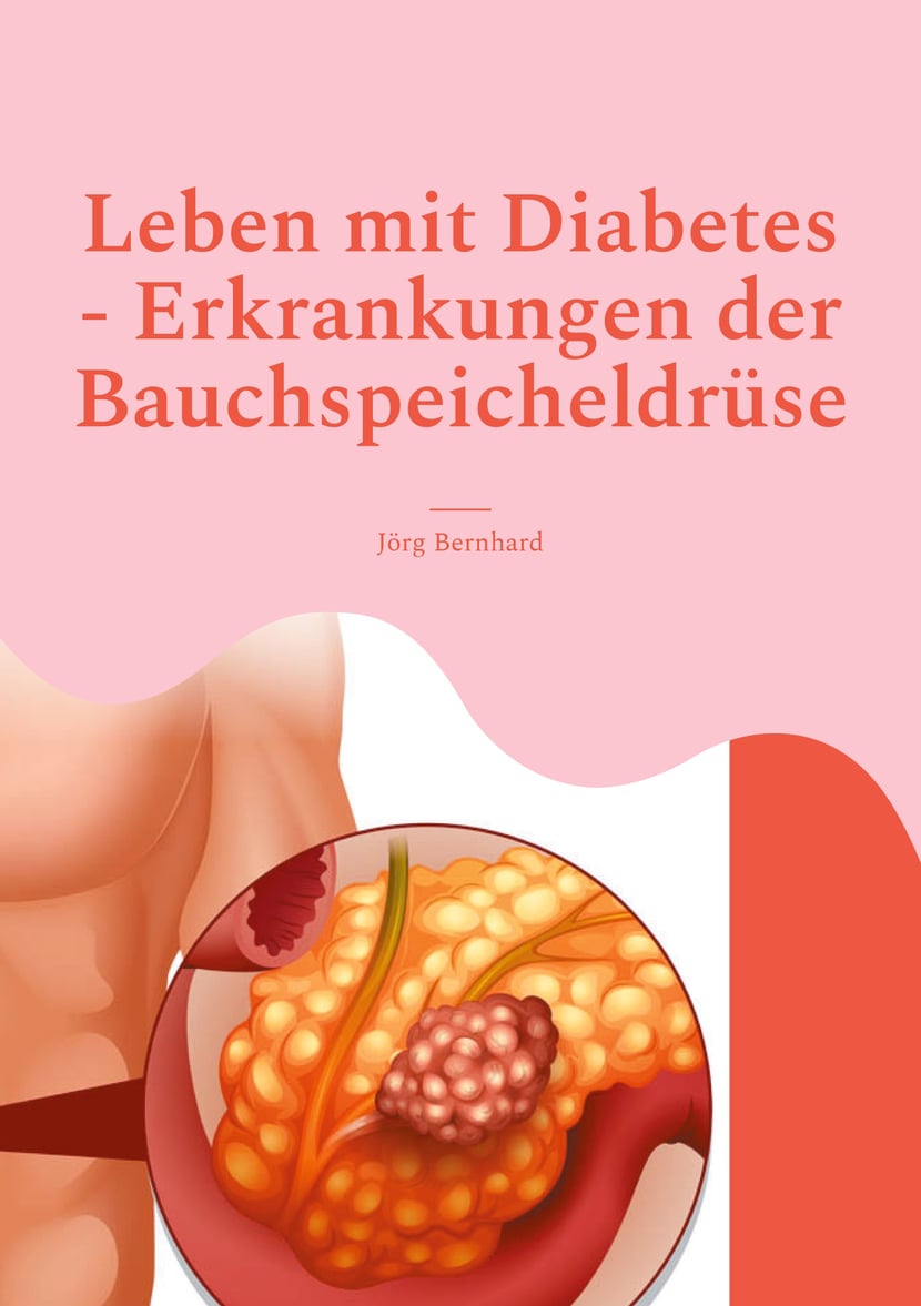 media/pim/13_metadata-image-76597531.jpeg