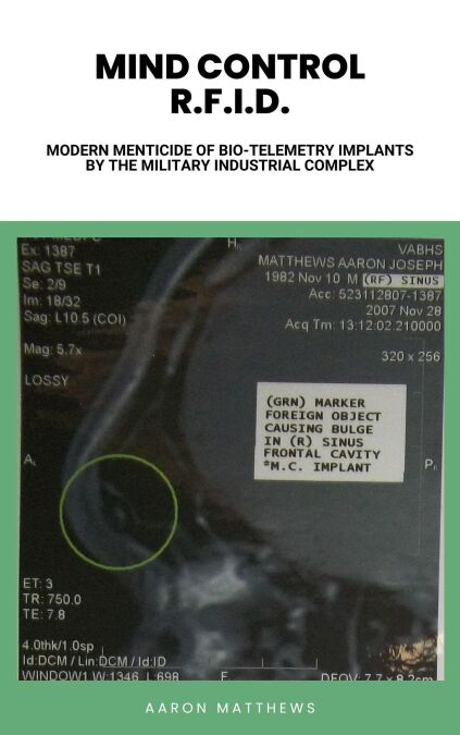 media/pim/33_ba0ca46c-af60-4435-8505-1835d9cd250d.jpeg