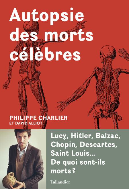 media/pim/5_1ddf4a29-2e45-4881-a745-a90452564703.jpeg