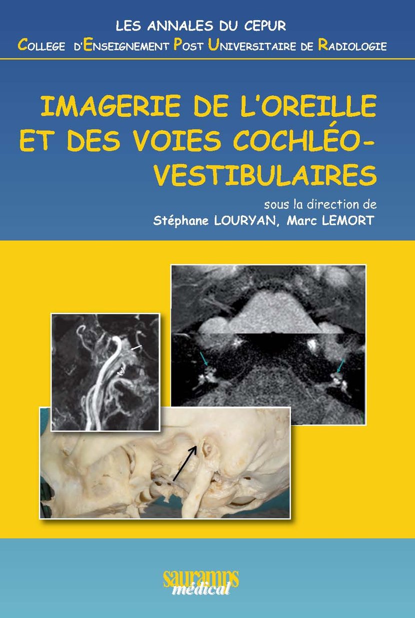 media/pim/5_metadata-image-71604823.jpeg