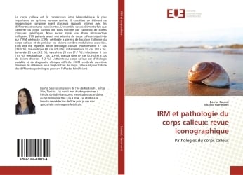 media/pim/9786138428794.jpg