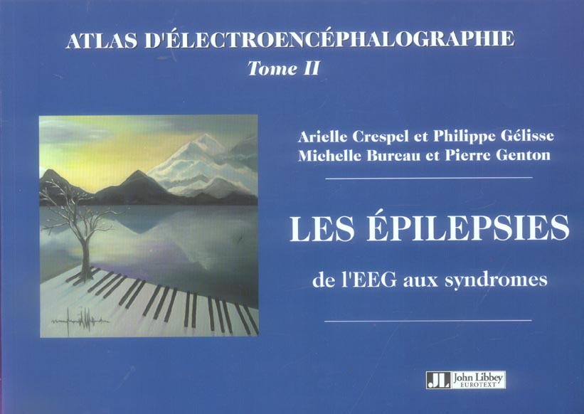 Les epilepsies de l'eeg aux syndromes. atlas d ...