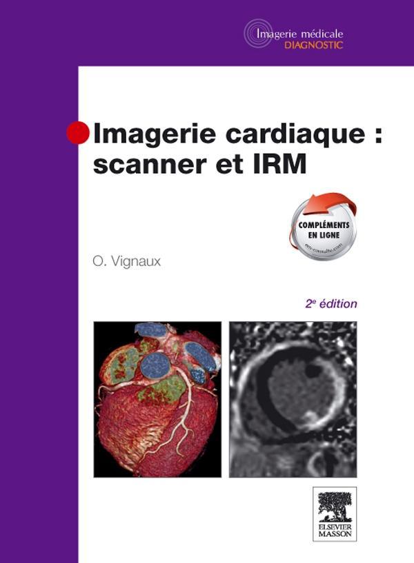 Scanner De Livre, Scanner À Livre